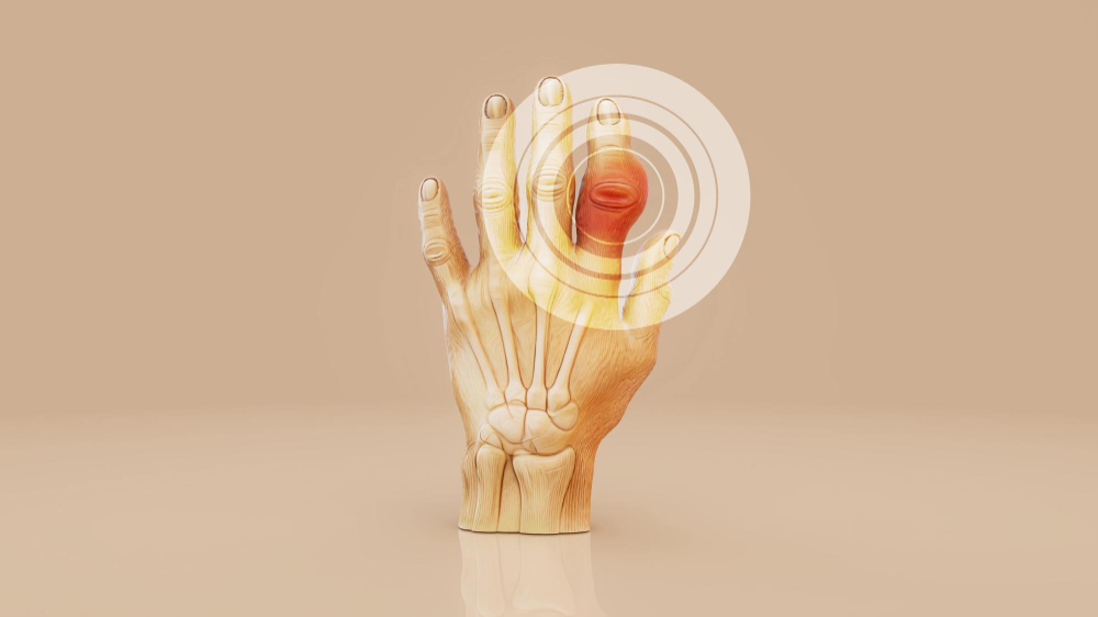 Orthopedics